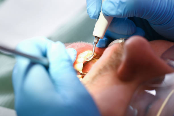 Best Tooth Infection Emergency Dentist  in Richmond, MN